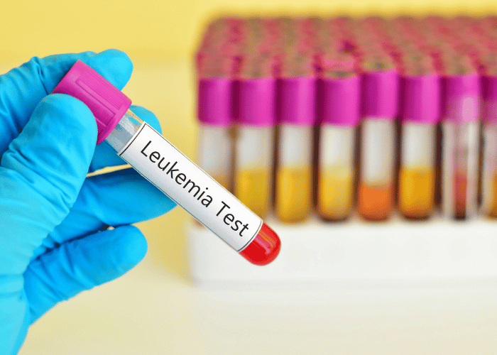 Leukemia