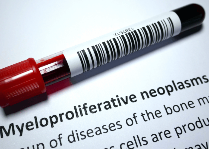 Myeloproliferative Neoplasm