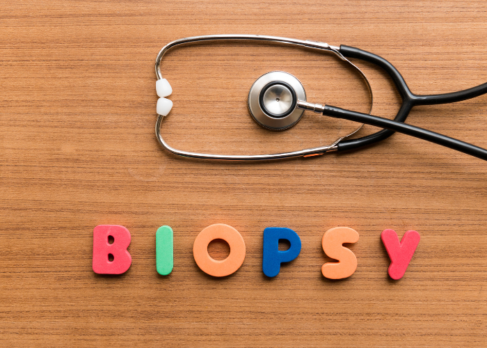 diagnostic biopsy